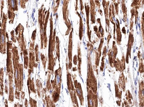 TGM2 / Transglutaminase 2 Antibody