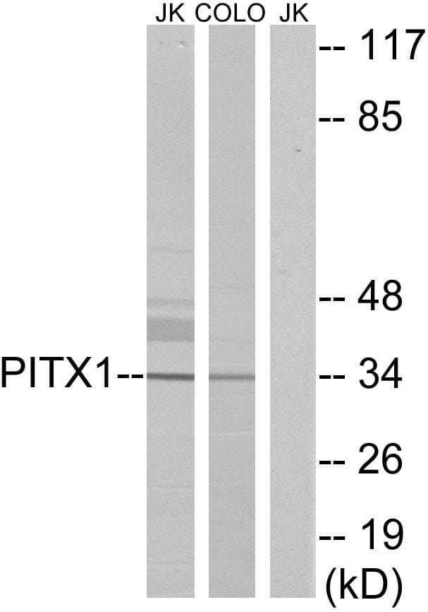 Polyclonal Rabbit anti-Human PITX1 Antibody (WB)