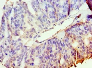 PAK2 Antibody (aa1-212)