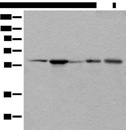 BAIAP2L1 Antibody