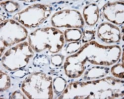 LIPG / Endothelial Lipase Antibody (clone OTI1B8)