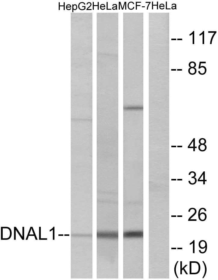 DNAL1 Antibody (aa121-170)