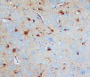 S100B / S100 Beta Antibody (C-Terminus)