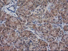 DSTN / Destrin Antibody (clone OTI1D5)