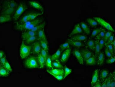 GPT / Alanine Transaminase Antibody (aa2-496)