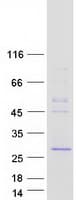 Human VCPKMT / C14orf138 Protein (Recombinant Myc-DDK (Flag))
