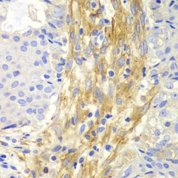 FLNA / Filamin A Antibody