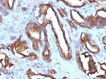 CD63 Antibody (clone NKI/C3 + LAMP3/968)