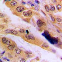 Polyclonal Rabbit anti-Human MAPK9 / JNK2 Antibody (Internal, IHC, WB)