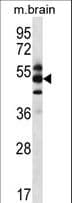 GPS1 / CSN1 Antibody (aa141-170)