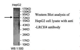 Polyclonal Rabbit anti-Human LRCH4 Antibody (aa119-299, IHC, WB)