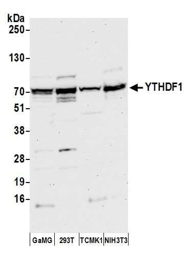 Polyclonal Rabbit anti-Human YTHDF1 Antibody (aa325-375, WB)