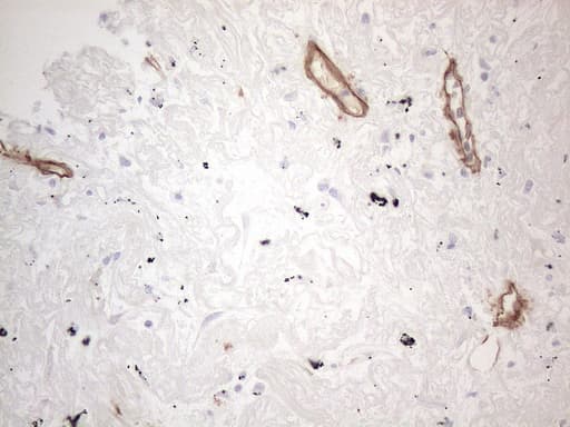 Monoclonal Mouse anti-Human CD34 Antibody (clone OTI11E1, Carrier-free, aa312-385, IHC, WB)
