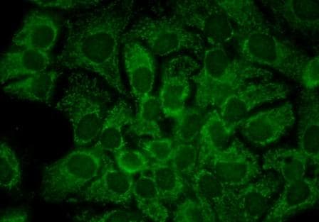 IHC-plus™ HSP90AA / HSP90 Alpha Antibody (clone 2G5.G3)