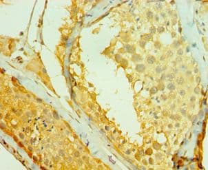 RAD1 Antibody (aa1-282)