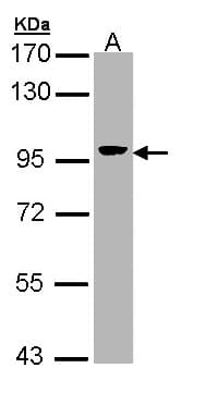 IHC-plus™ VIL1 / Villin Antibody (aa7-246)