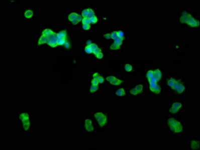 Polyclonal Rabbit anti-Human CLN5 Antibody (IF)