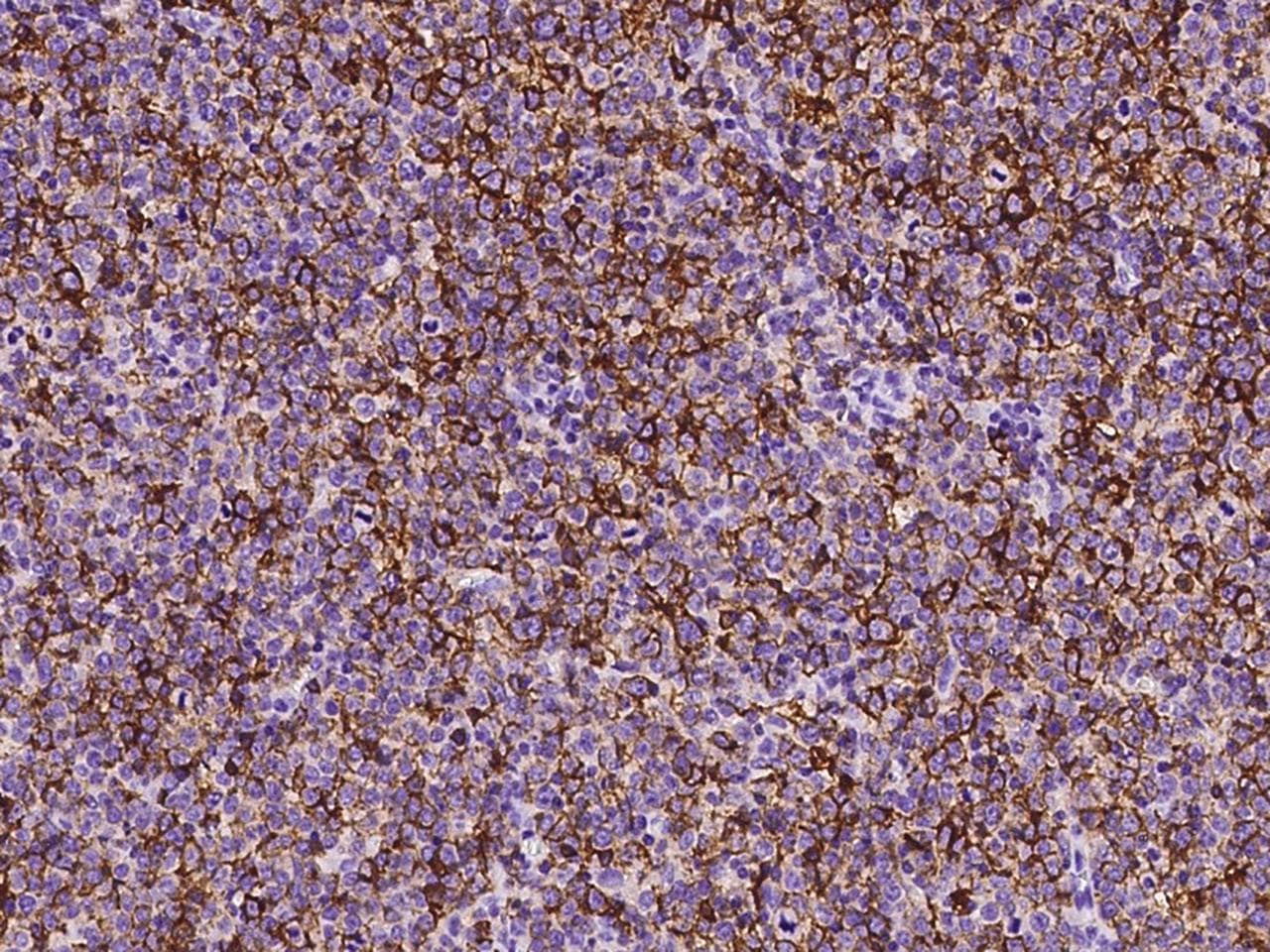 Monoclonal Mouse anti-Human CD20 Antibody (clone 06, Preservative Free, IHC)