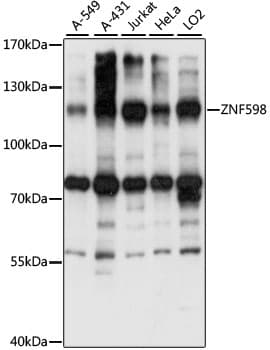 Polyclonal Rabbit anti-Human ZNF598 Antibody (WB)