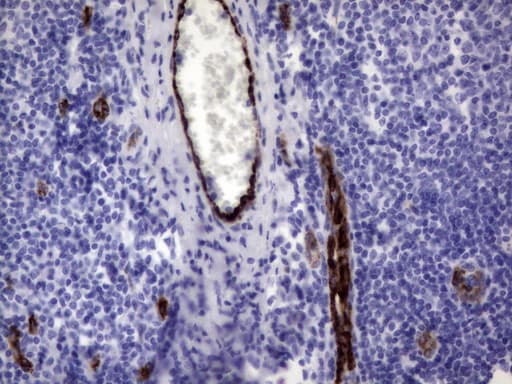 VWF / Von Willebrand Factor Antibody (aa764-1263, clone OTI2D10)