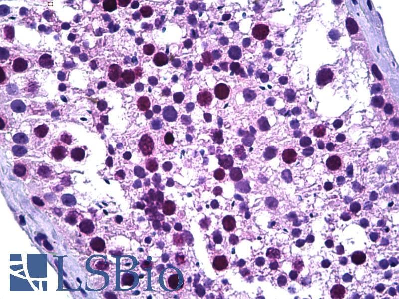 IHC-plus™ TPX2 Antibody (aa301-350)