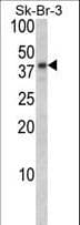 Polyclonal Rabbit anti-Human BGN / Biglycan Antibody (aa148-176, IHC, WB)