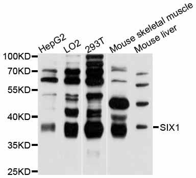 Polyclonal Rabbit anti-Human SIX1 Antibody (WB)