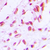 Polyclonal Rabbit anti-Human RB1 / Retinoblastoma / RB Antibody (phospho-Ser780, IHC, IF, WB)