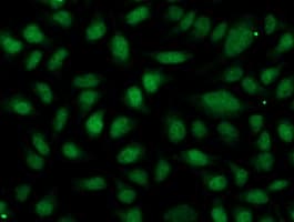 OGFOD1 Antibody (clone OTI1D9)