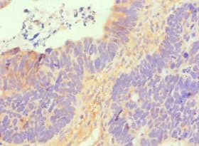 Polyclonal Rabbit anti-Human SLC2A1 / GLUT-1 Antibody (aa210-310, IHC, WB)