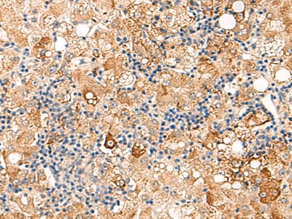 SEC22B Antibody