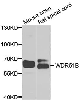 POC1B / WDR51B Antibody