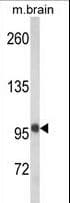 HCCS1 / VPS53 Antibody (aa111-140)