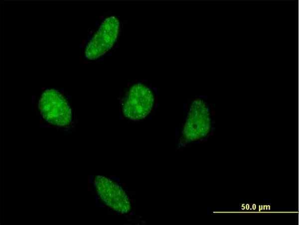 VRK1 Antibody (clone 4F9)