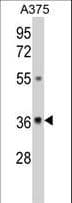 GALE / UDP-Glucose 4-Epimerase Antibody (aa142-171)