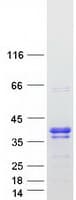 Human RRP15 Protein (Recombinant Myc-DDK (Flag))