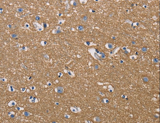 Polyclonal Rabbit anti-Human GPM6A / Glycoprotein M6A Antibody (IHC, WB)