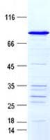 Human TP53 / p53 Protein (Recombinant GST-His, N-terminus)