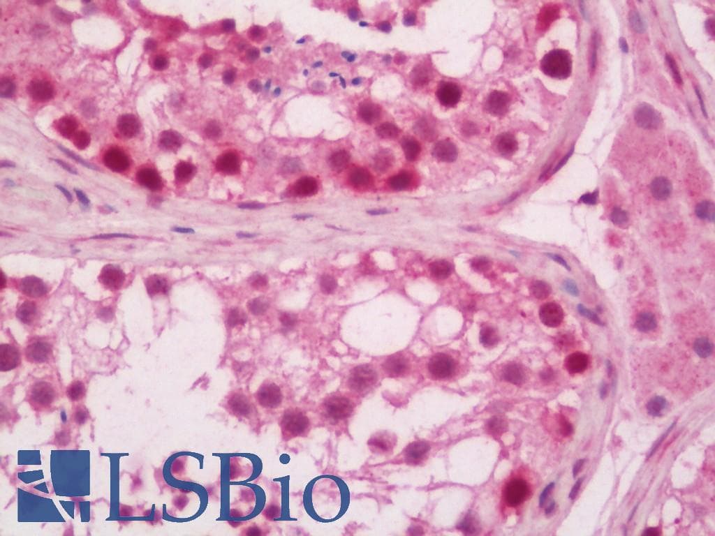 IHC-plus™ TRB3 / TRIB3 Antibody