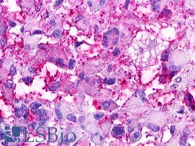 PathPlus™ GPRC5D Antibody (Extracellular Domain)