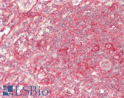 PathPlus™ Polyclonal Rabbit anti-Human PSAP / Prosaposin Antibody (Internal, IHC, WB)