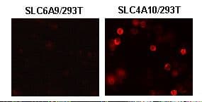 Polyclonal Rabbit anti-Human SLC4A10 Antibody (IHC)
