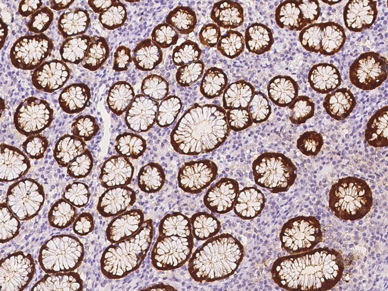 Polyclonal Rabbit anti-Human SULT1C2 / Sulfotransferase 1C2 Antibody (IHC)