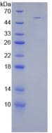 Human STC1 / Stanniocalcin Protein (Recombinant His-GST, N-terminus)