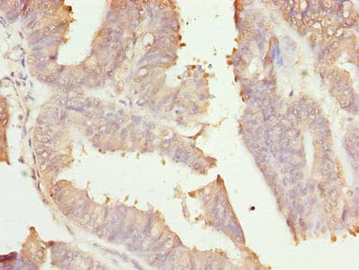 RER1 Antibody