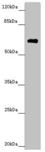 Polyclonal Rabbit anti-Human SOCS4 Antibody (IHC, WB)