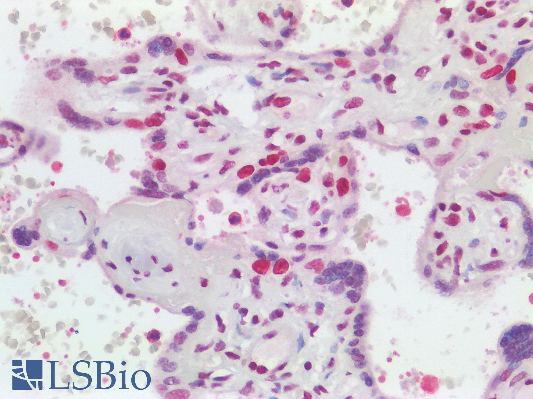 IHC-plus™ Polyclonal Rabbit anti-Human CSTF2 / CstF-64 Antibody (aa527-577, IHC)