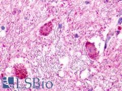 PathPlus™ Polyclonal Rabbit anti-Human NMUR1 Antibody (C-Terminus, IHC)