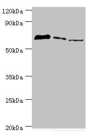 Polyclonal Rabbit anti-Human TDP1 Antibody (aa1-260, IHC, WB)