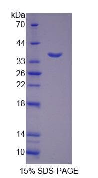Human FKSG40 / KAZALD1 Protein (Recombinant His-S)